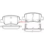 Гальмiвнi колодки (вир-во Remsa) 